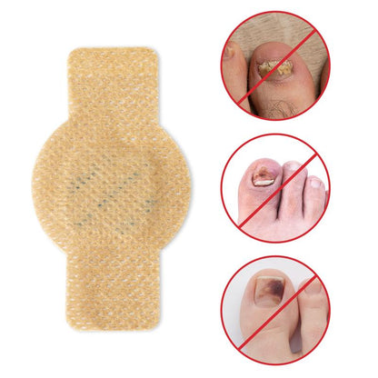 Overnight Nail Renewal Patches – For Yellow, Rough & Damaged-Looking Toenails, 21 Patches