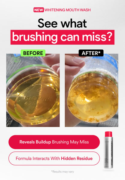 Stain Whitening Mouthwash