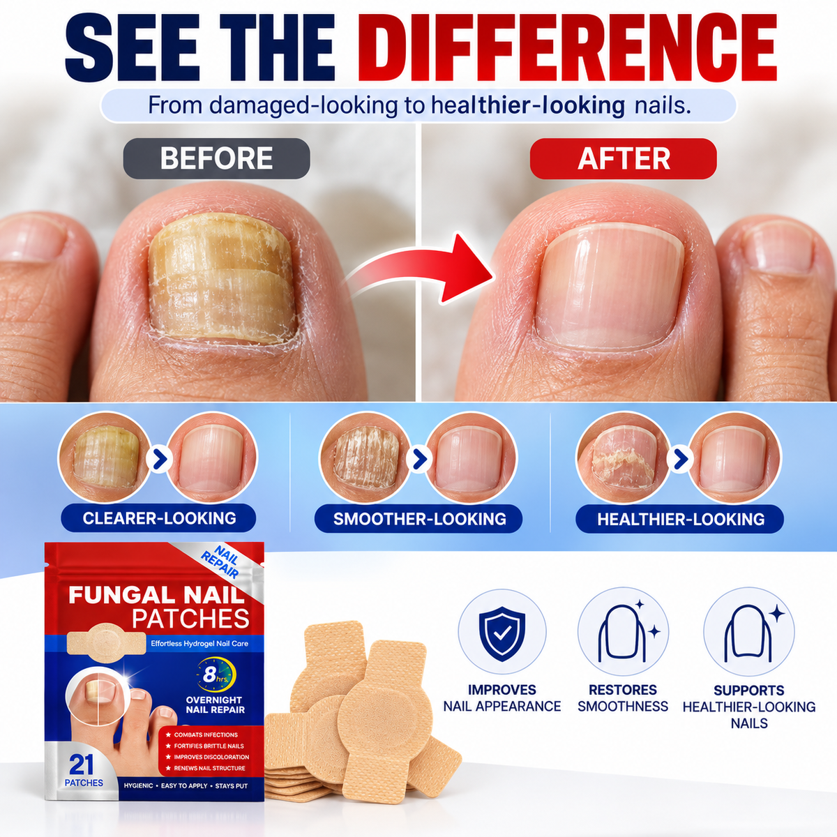 Overnight Nail Renewal Patches – For Yellow, Rough & Damaged-Looking Toenails, 21 Patches