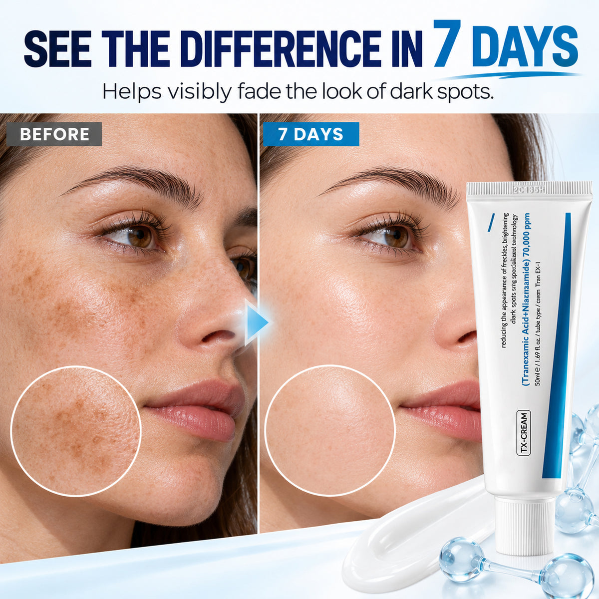 Advanced Dark Spot & Post-Blemish Mark Correcting Cream – Brighter, More Even-Looking Skin, 50ml