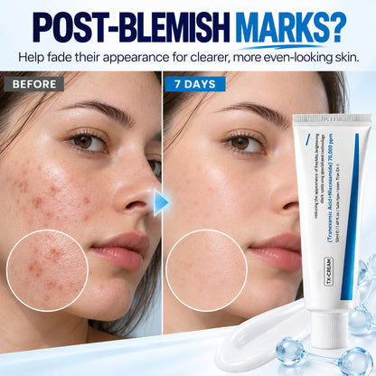 Advanced Dark Spot & Post-Blemish Mark Correcting Cream – Brighter, More Even-Looking Skin, 50ml